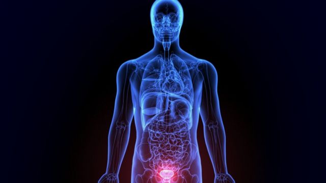 cirurgia de prostata